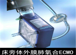 邁柯唯  床旁體外膜肺氧合ECMO